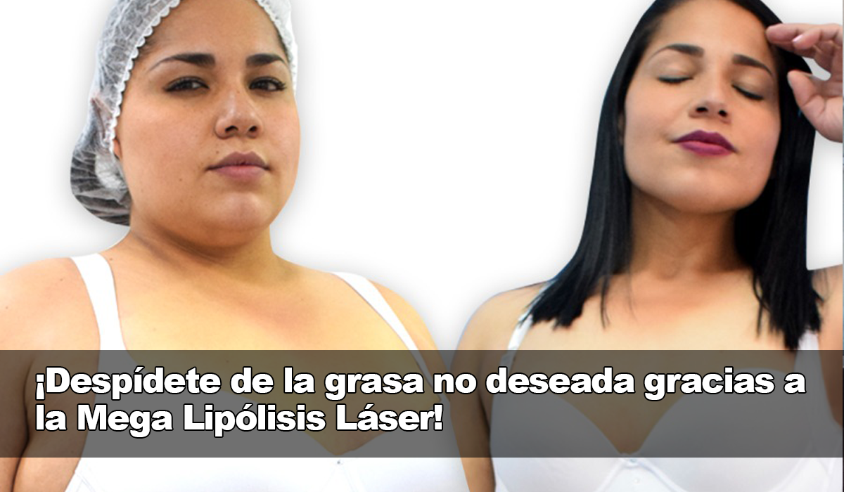 La Mega Lipólisis Láser, la respuesta segura para deshacerse de la grasa no deseada